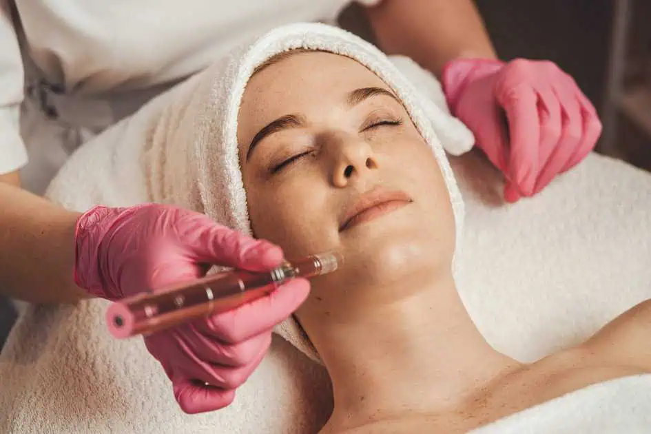 Microneedling treatment in Hollidaysburg, PA by Glow Aesthetics Bar