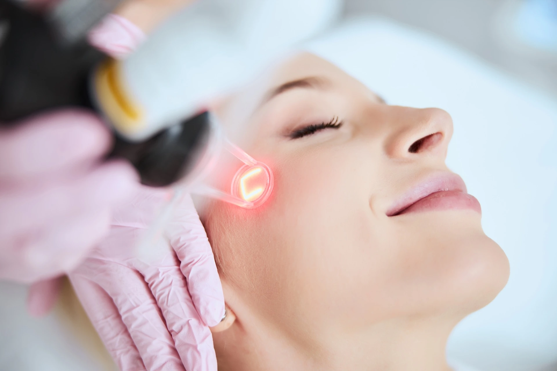 Laser Skin Resurfacing in Hollidaysburg, PA